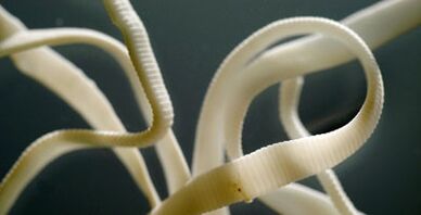 επίπεδο παράσιτο από το ανθρώπινο σώμα