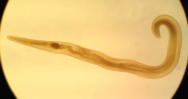 Τα pinworms είναι ένας κοινός τύπος στρογγυλού παρασίτου που προκαλεί εντεροβίαση.